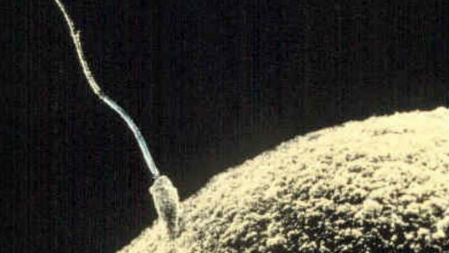 Мутации открити в спермата на бащата могат да предскажат риска