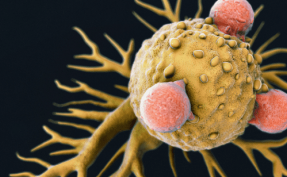 Откриха случайно имунна клетка-убиец на рак