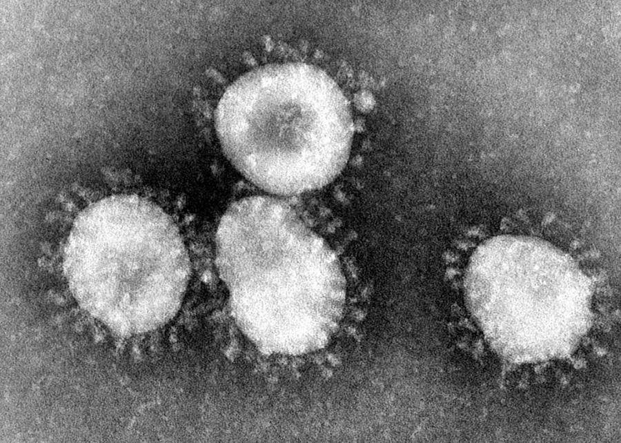 Коронавируси, снимка от електронен микроскоп, 1975 г., wikimedia.org