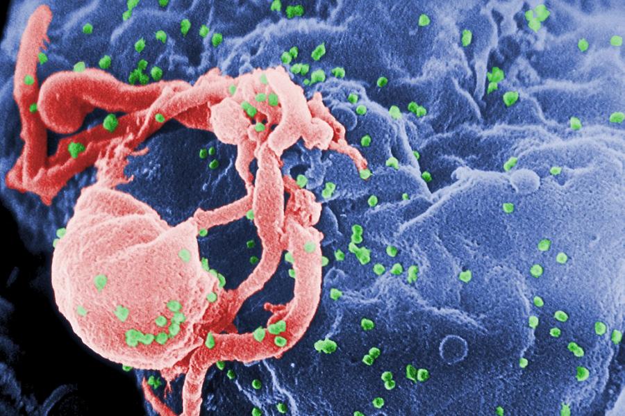 Пъпкуване на HIV-1 (в зелено) от култивиран лимфоцит, илюстрация: Wikimedia.org