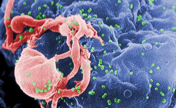 За първи път излекуваха напълно жена с HIV