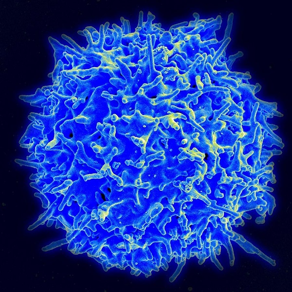Т-клетка, снимка: Wikimedia.org