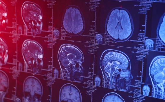 Център за оцеляване е открит в човешкия мозък
