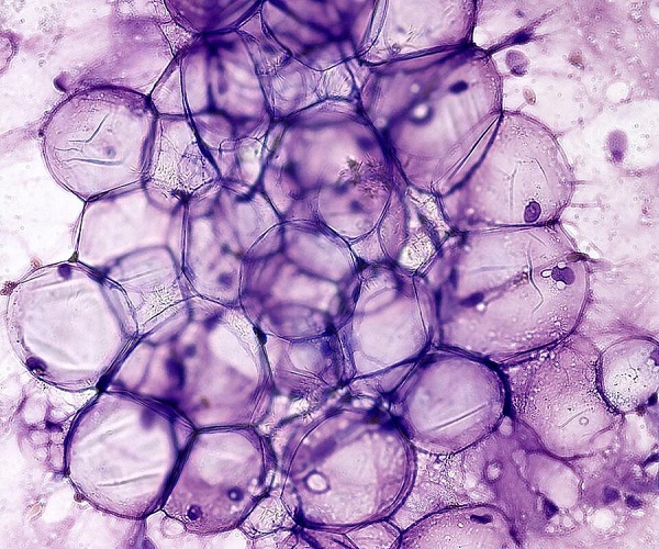 Снимка: Макизъм, лиценз Creative Commons Attribution-Share Alike 4.0, Wikimedia Commons