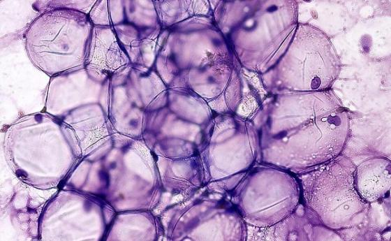 Мастните клетки „помнят“, че са по-големи и се държат така